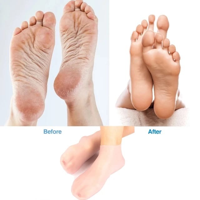 ORIGINAL SILICON MOISTURIZING SOCKS