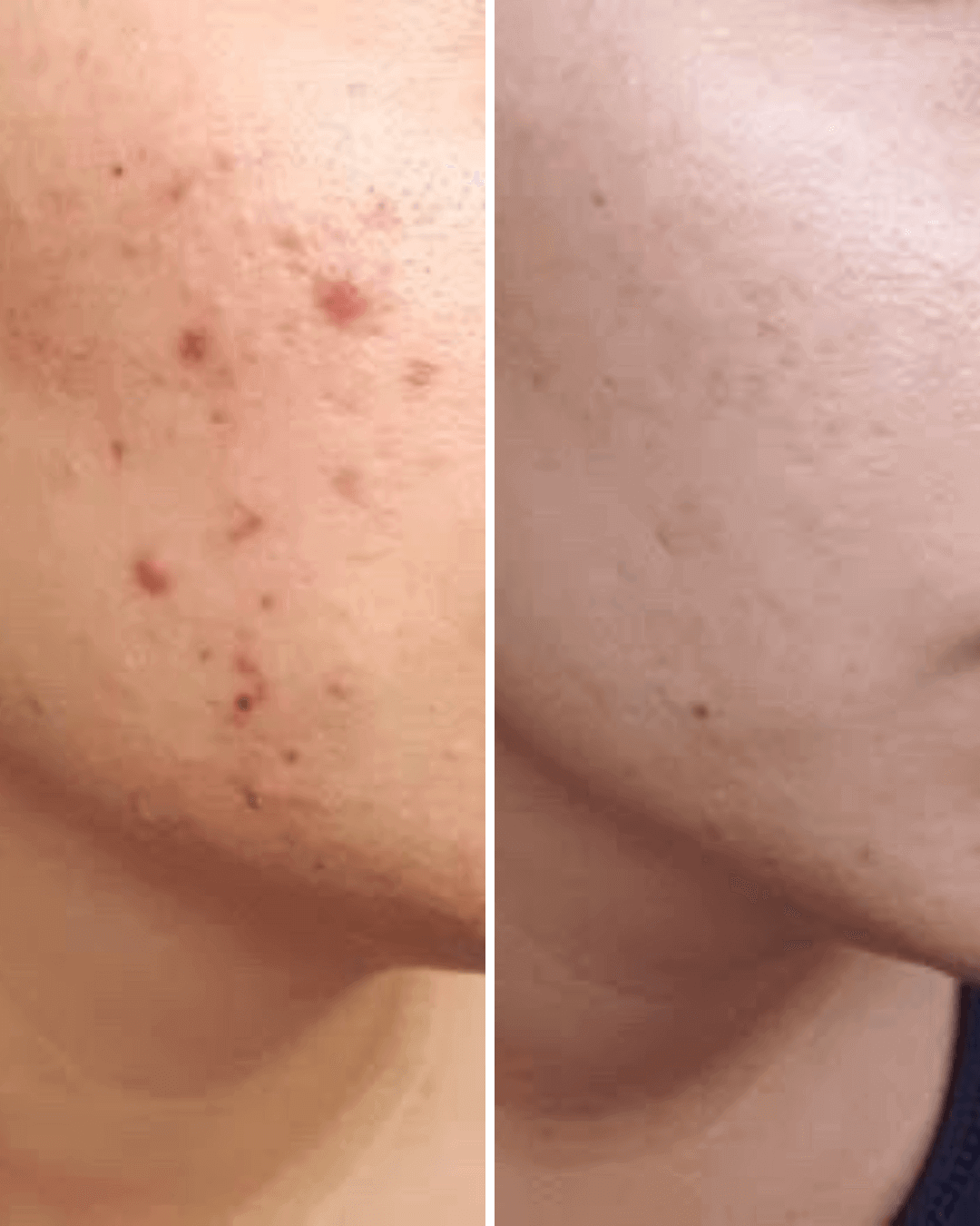 Vitamin C + E Serum for Brightens Skin To Reduce Dark Spots and Boost Radiance Anti-Aging Properties, Hydrates Deeply, Lightweight Formula, Suitable for All Skin Types Nirvana Botanics